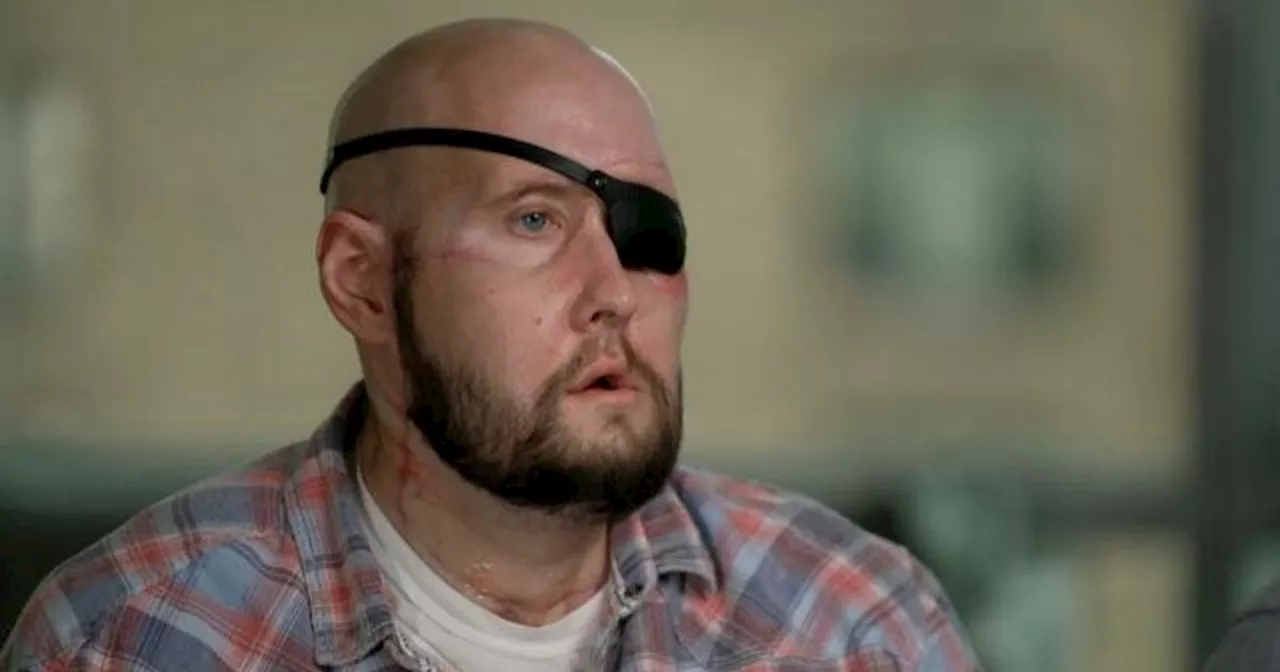 Arkansas Man Receives First-Ever Human Eye Transplant