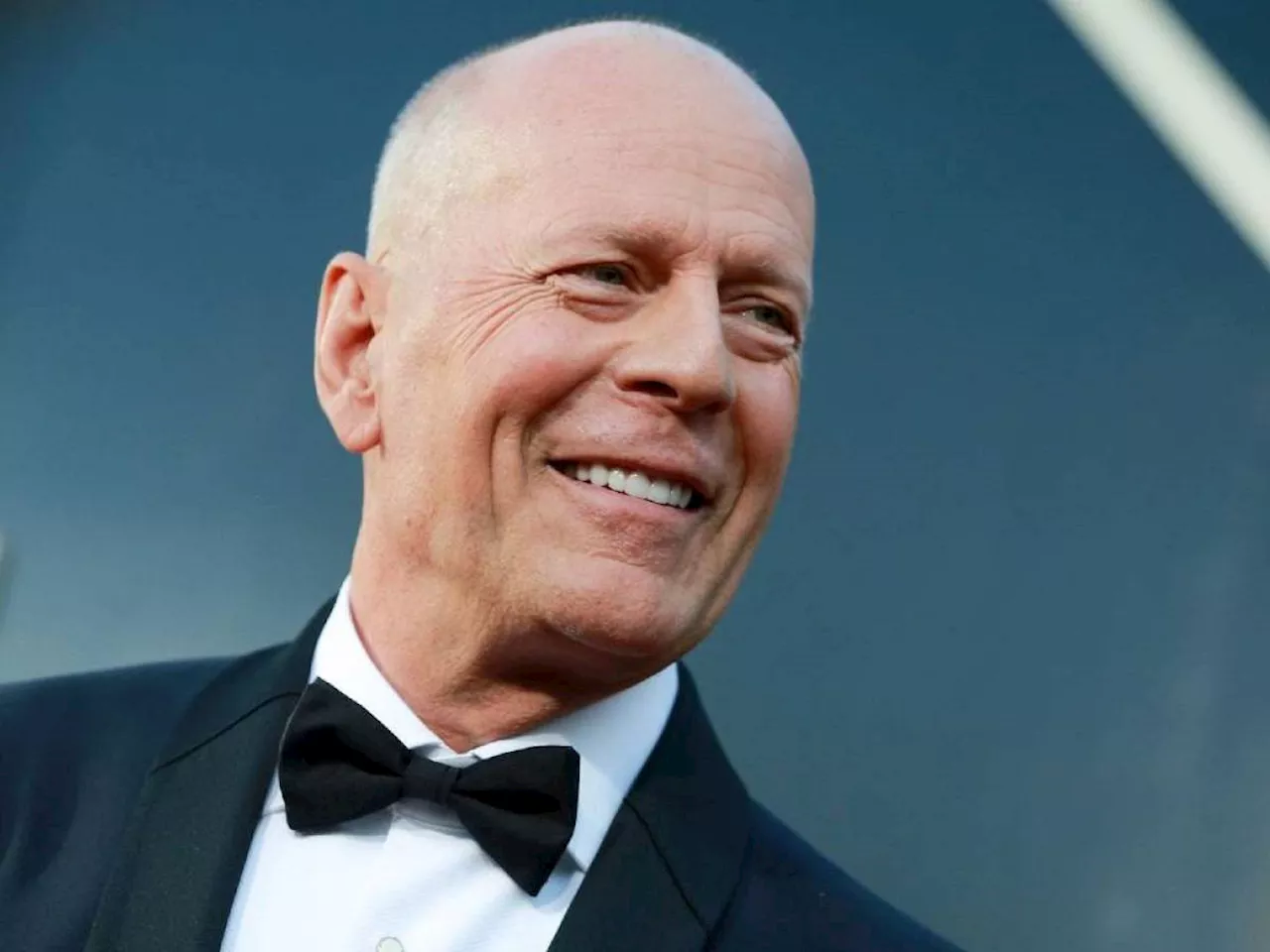 L'afasia, i ricordi, il rapido peggioramento: la malattia che sta consumando Bruce Willis