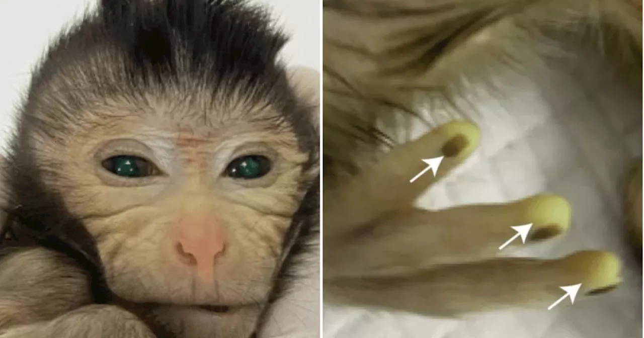 Scientists create 'Frankenstein' chimera monkey that glows green