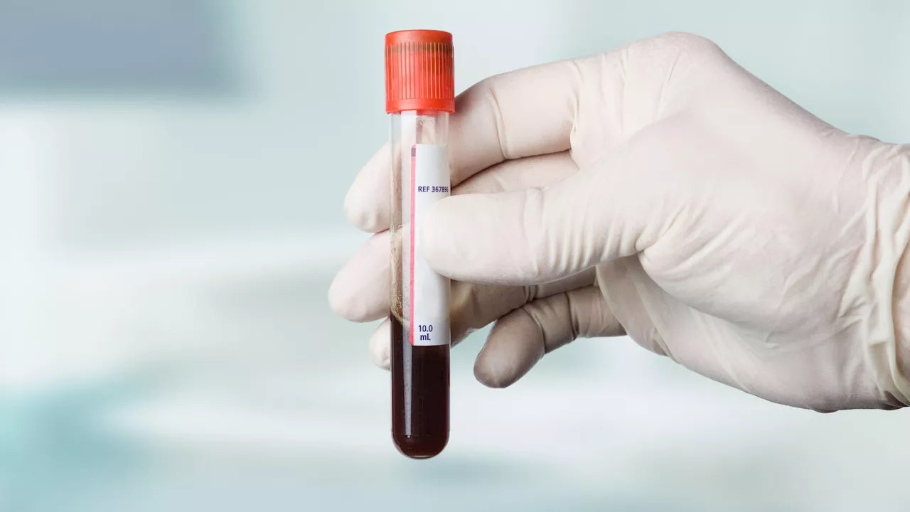 ‘Revolutionary’ first blood tests to diagnose Alzheimer’s will be available on NHS within years...