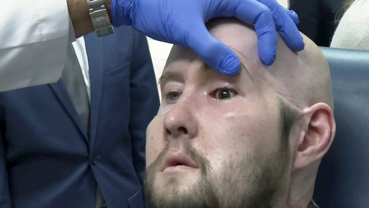 Surgeons Perform World's First Transplant of Entire Human Eye