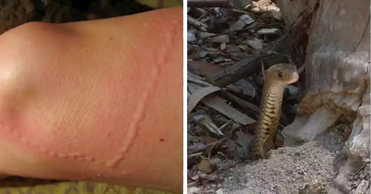 Australians Are Sharing Stories About Venomous Bites And I'm Actually Horrified