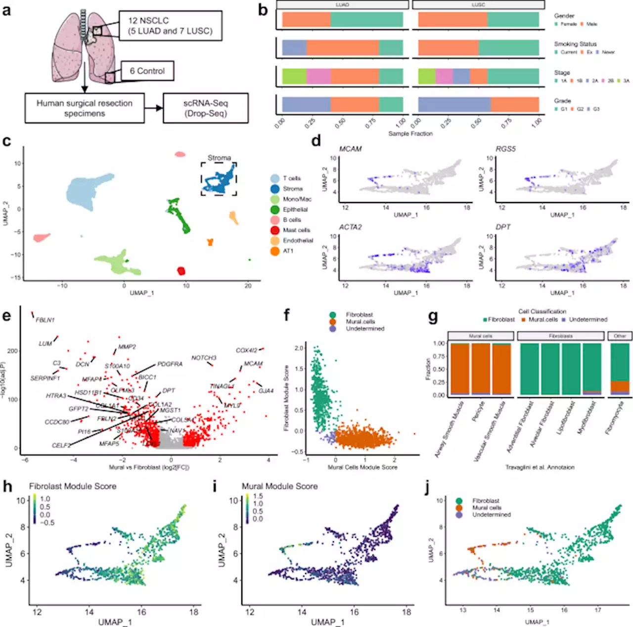 Single-cell analysis reveals prognostic fibroblast subpopulations linked to molecular and immunological subtypes of lung cancer - Nature Communications