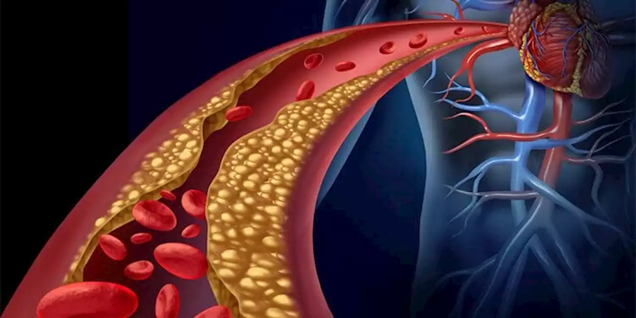 El colesterol HDL o 'bueno', no siempre beneficia a la salud del corazón