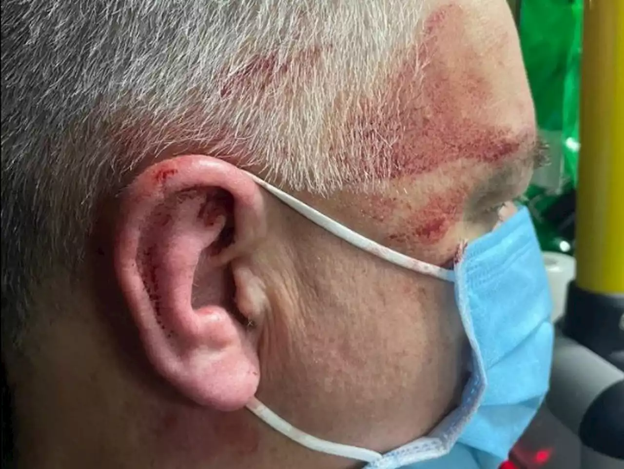 Man jailed for two years after breaking paramedic’s jaw