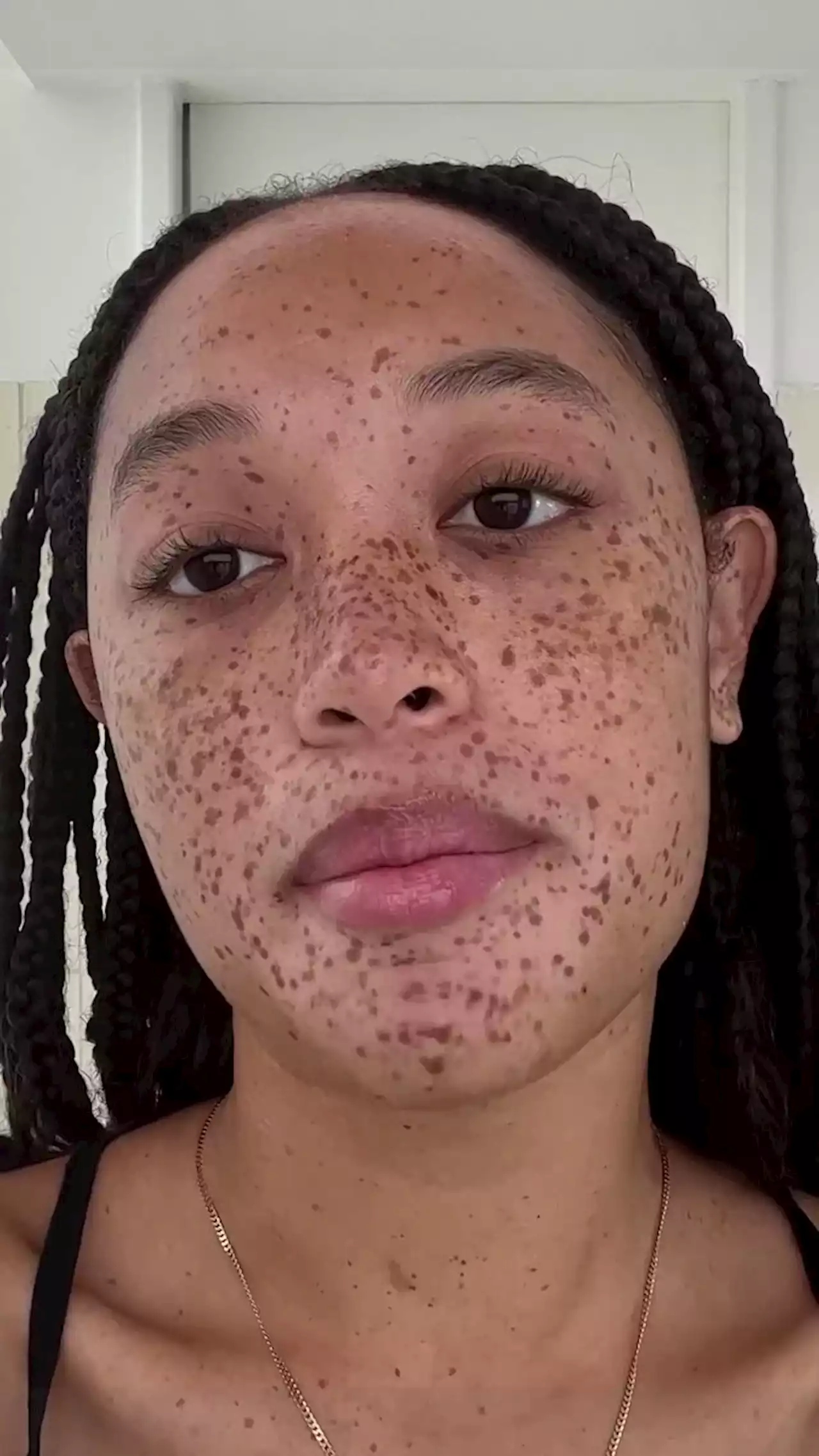 Salem Mitchell’s Guide to Embracing Freckles and Maintaining Knotless Braids