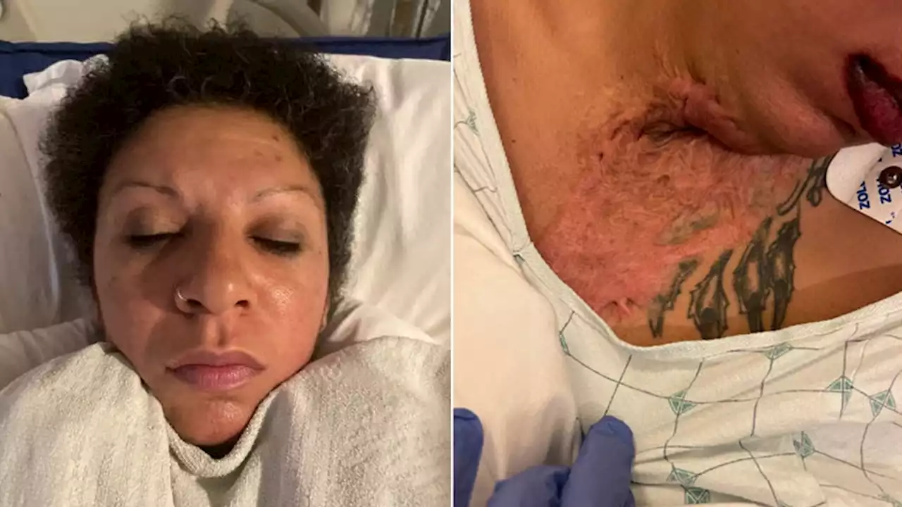 UCSF hospital seeks public’s help identifying patient