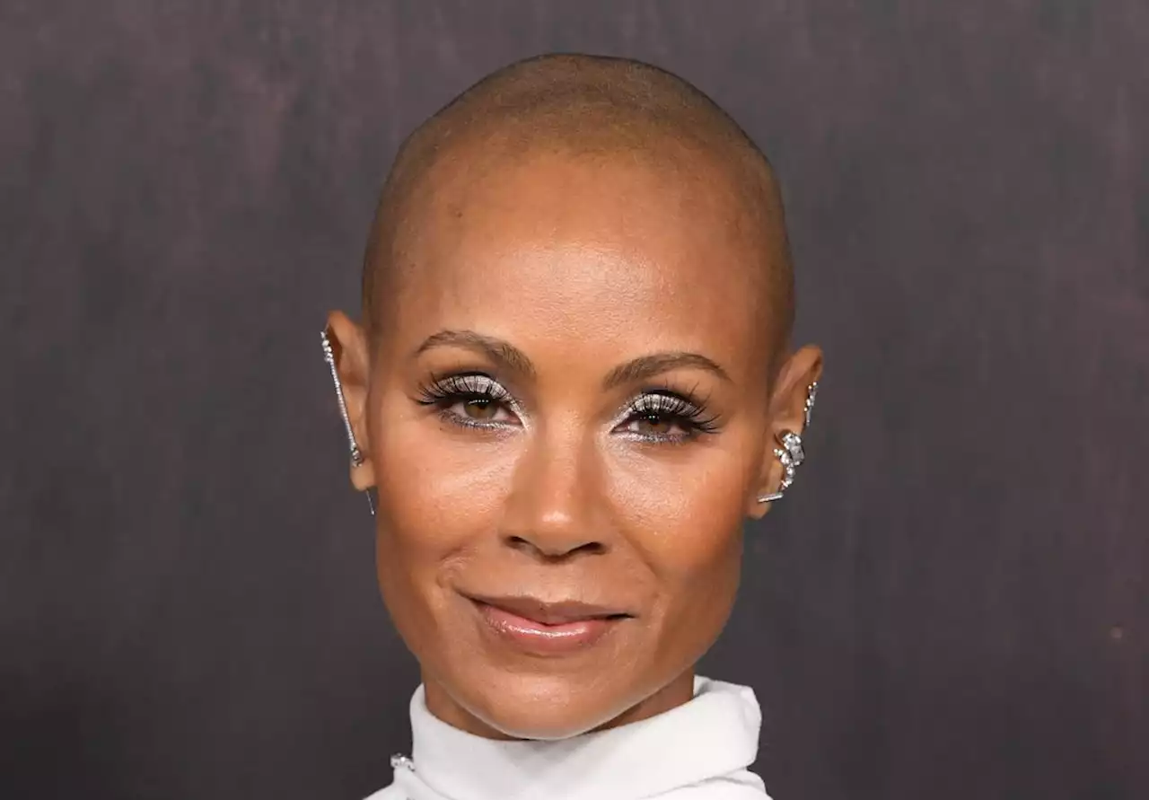 Jada Pinkett Smith Reveals Lessons Of Alopecia At Centre Of Oscars 2022 Slap Scandal