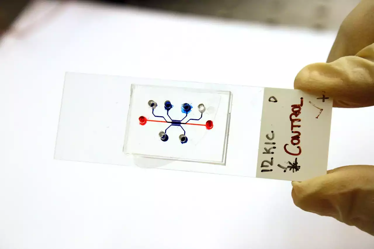 Cancer Cells Turned Into Logic Gates To Unravel the Secret of Their Movement