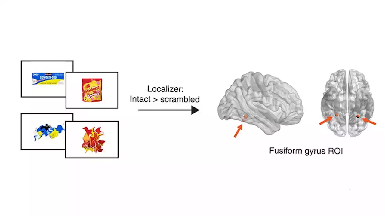 Brain scans sound like a terrifying way to resolve logo disputes