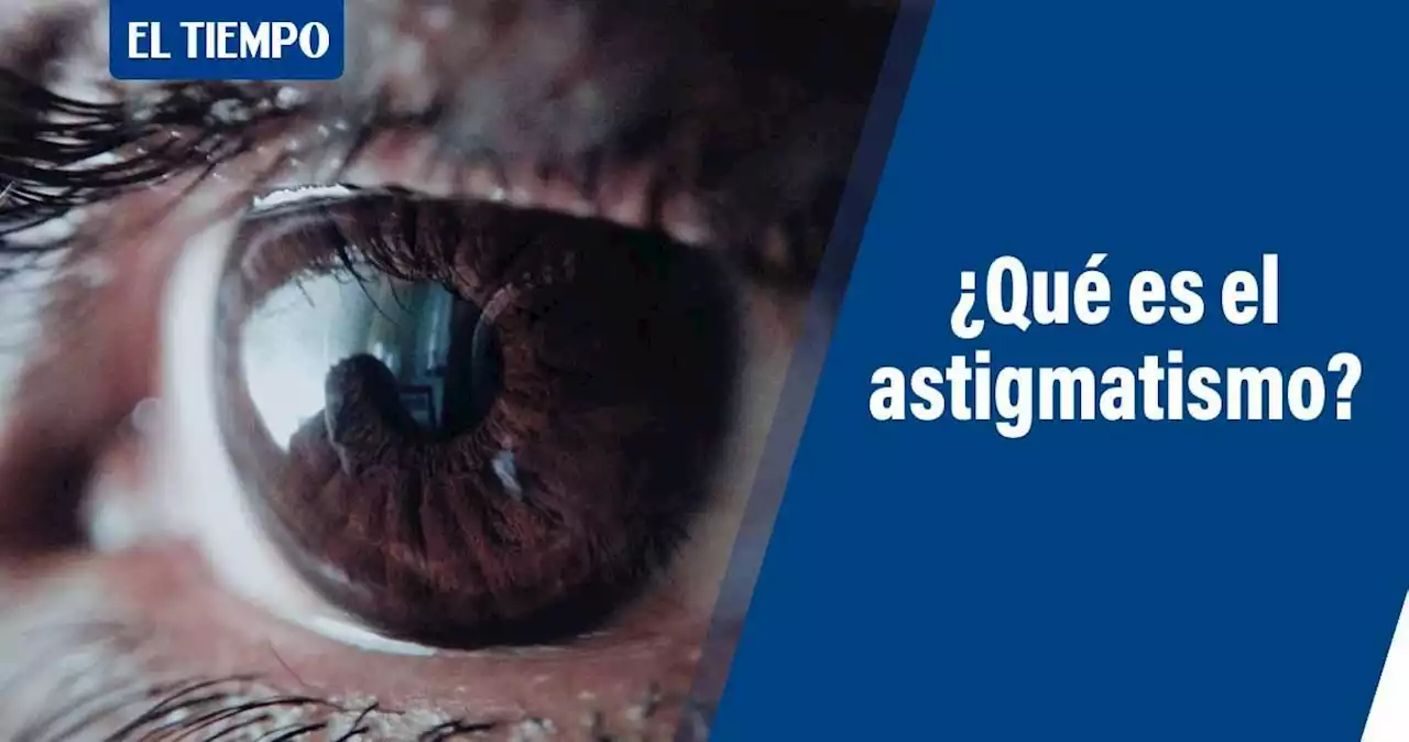 Astigmatismo: qué es, síntomas y tratamiento de este defecto visual