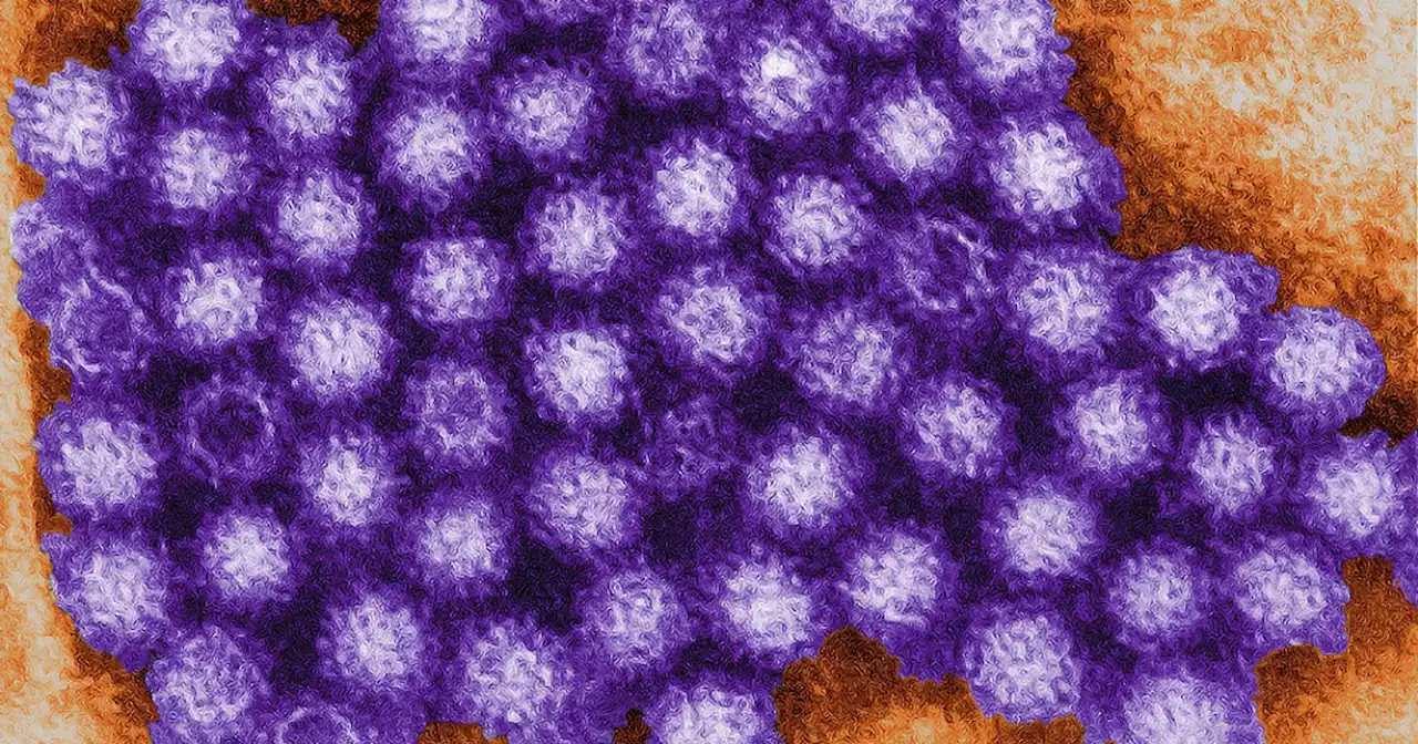 The length of Norovirus and if the 'winter vomiting bug' is contagious