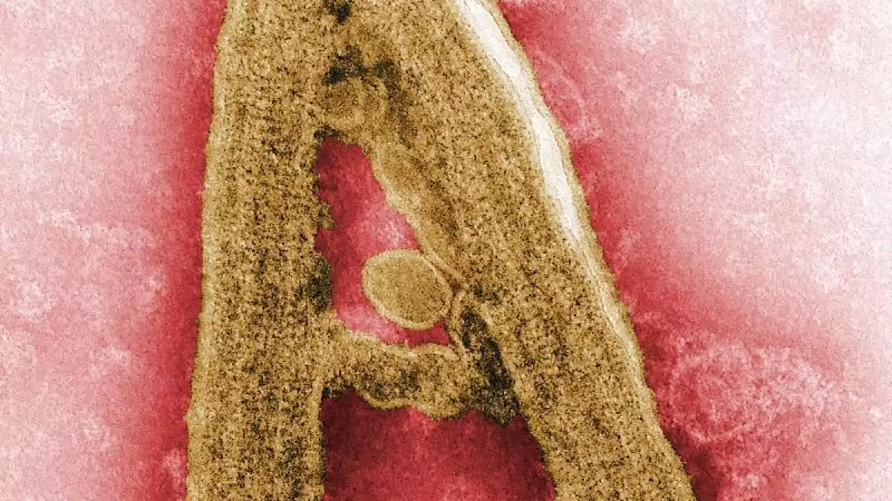 Neun Menschen sterben in Äquatorialguinea am Marburg-Virus