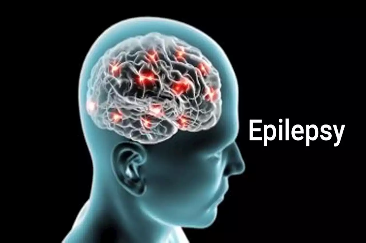 Paradigma baru Penanganan Komprehensif Kasus Epilepsi