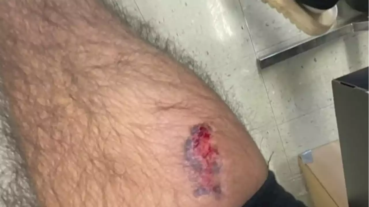 ‘I was screaming and nobody was helping me’: 2 students say they were bitten, hit with tennis racket by Kashmere High School gym teacher