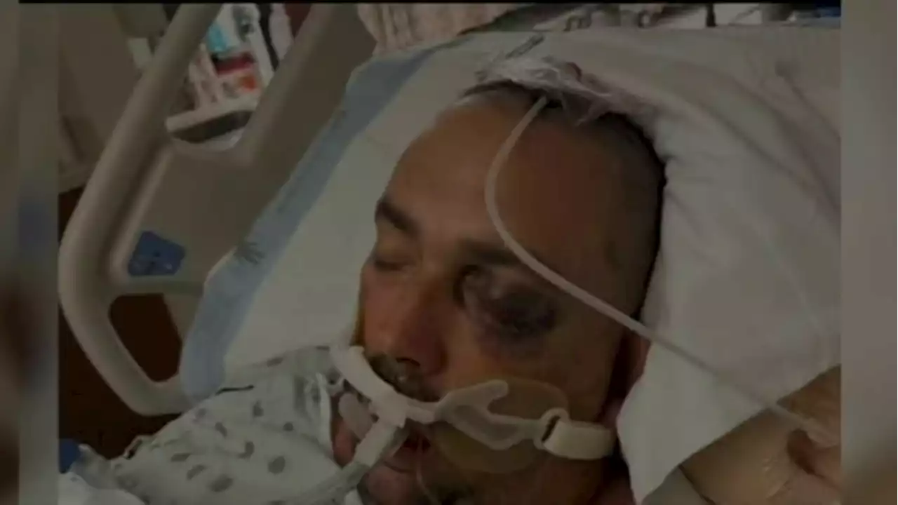 Lawsuit filed against Harris County after man claims jailers beat him into a monthlong coma