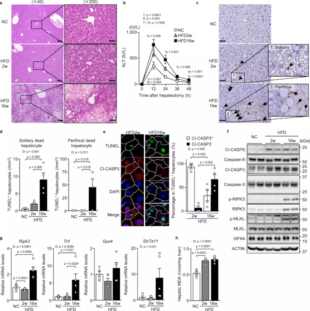 The transcription factor ATF3 switches cell death from apoptosis to necroptosis in hepatic steatosis in male mice - Nature Communications