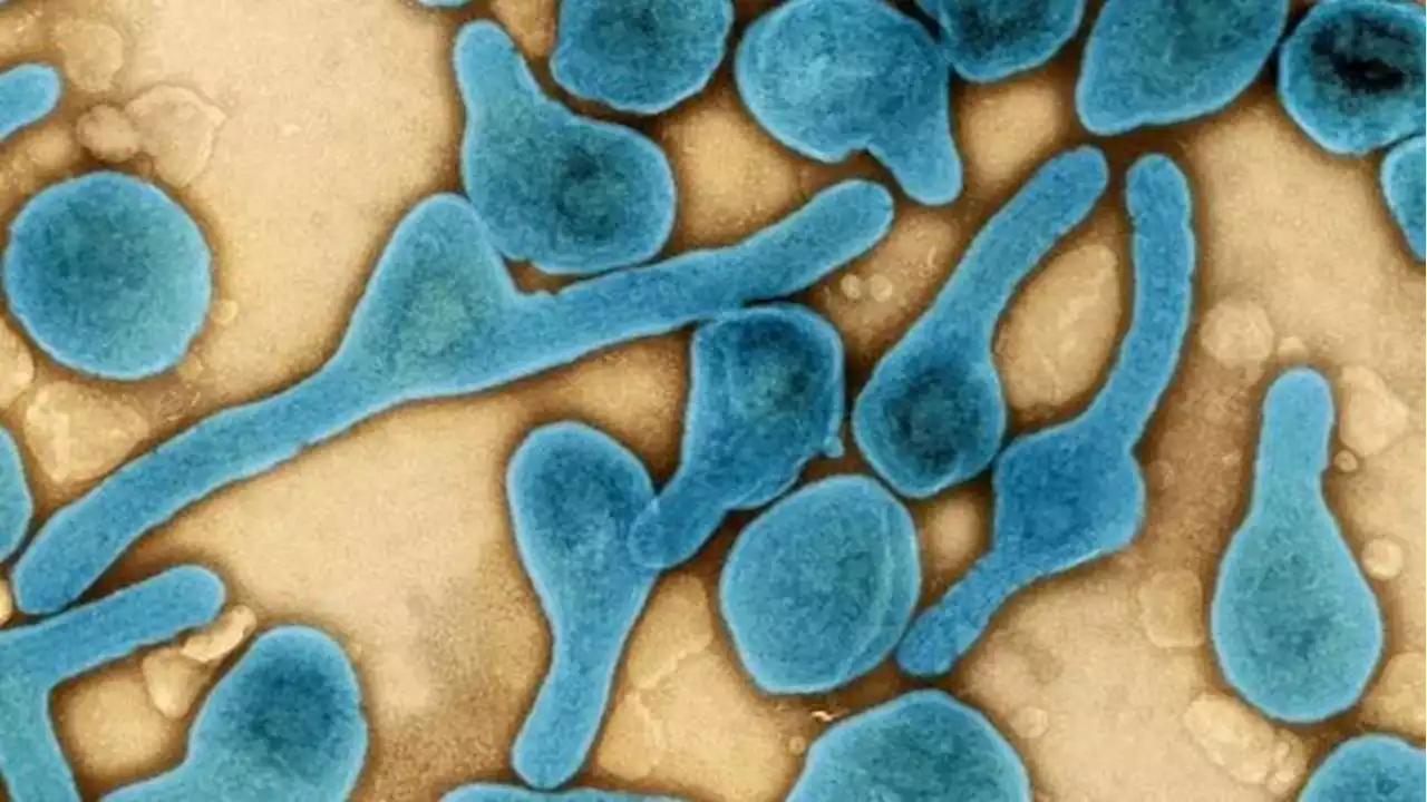 Virus de Marburgo en Guinea Ecuatorial con nueve muertos: ¿podría causar una nueva pandemia?