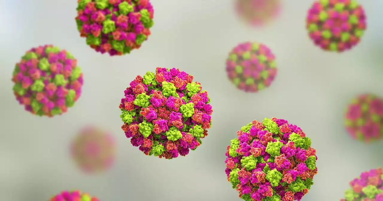 Norovirus cases spike as HSE advises how to avoid catching the vomiting bug