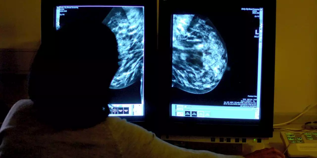 More Women With Breast Cancer Could Skip Harsh Radiation, Study Says