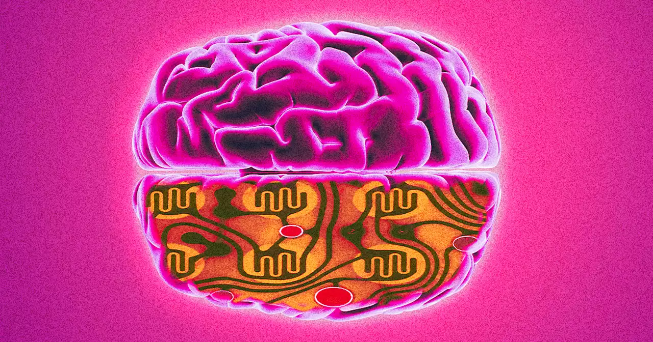 Brain Chips Like Neuralink Cause Strange Cognitive Changes, Doctors Say