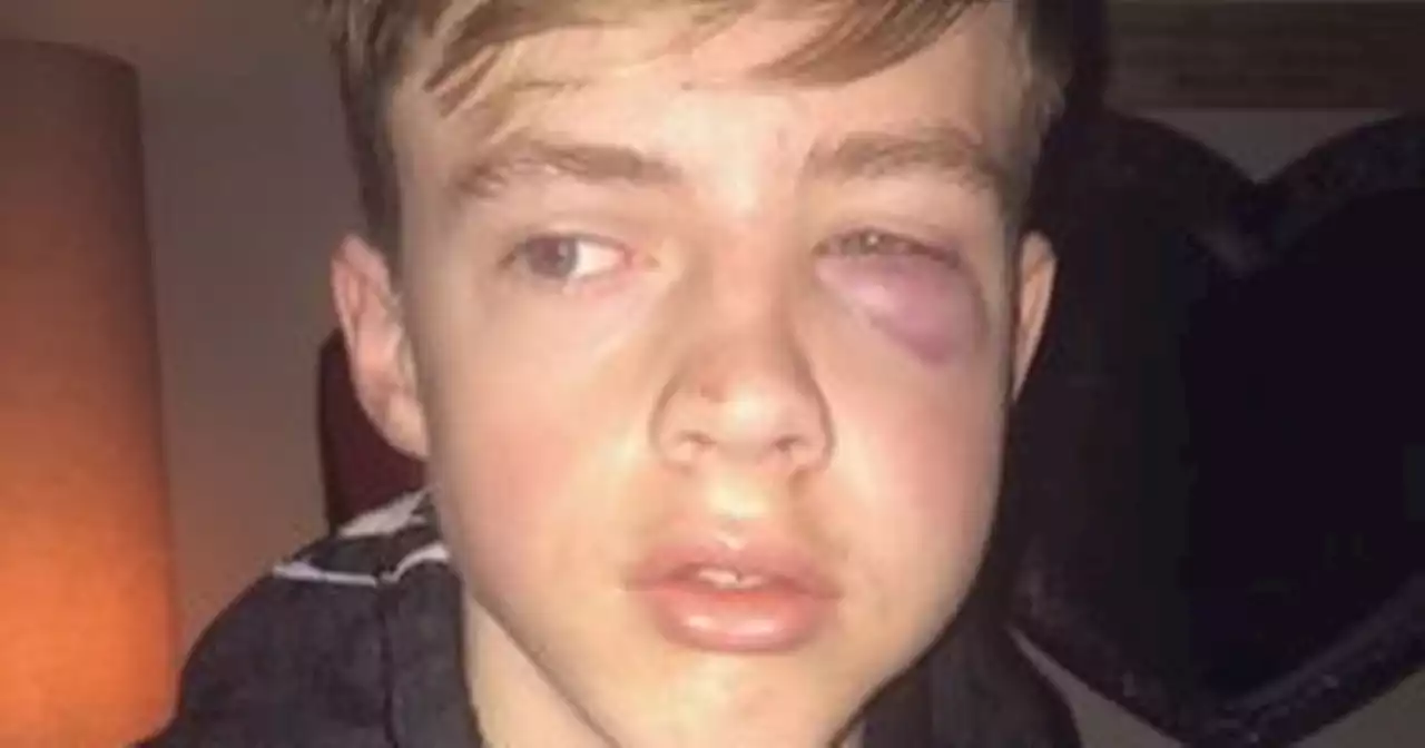 Teen's horrific injuries after being 'punched' by opposition footballer