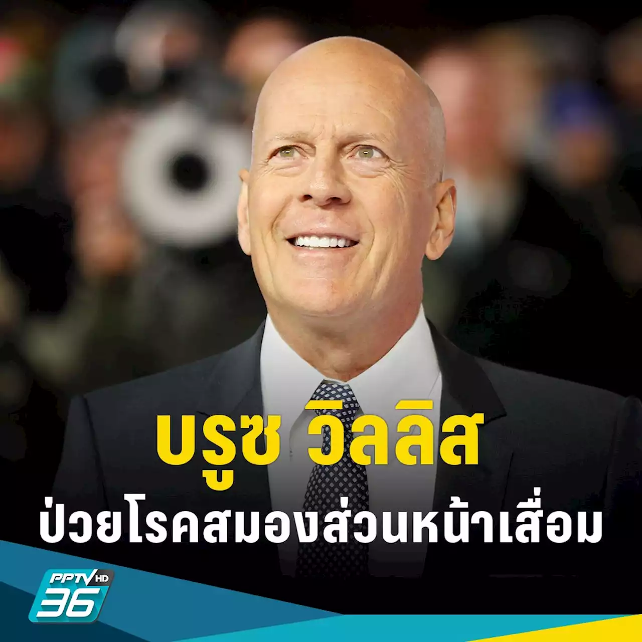 ดาราฮอลลีวูด “บรูซ วิลลิส” ป่วยโรคสมองส่วนหน้าเสื่อม