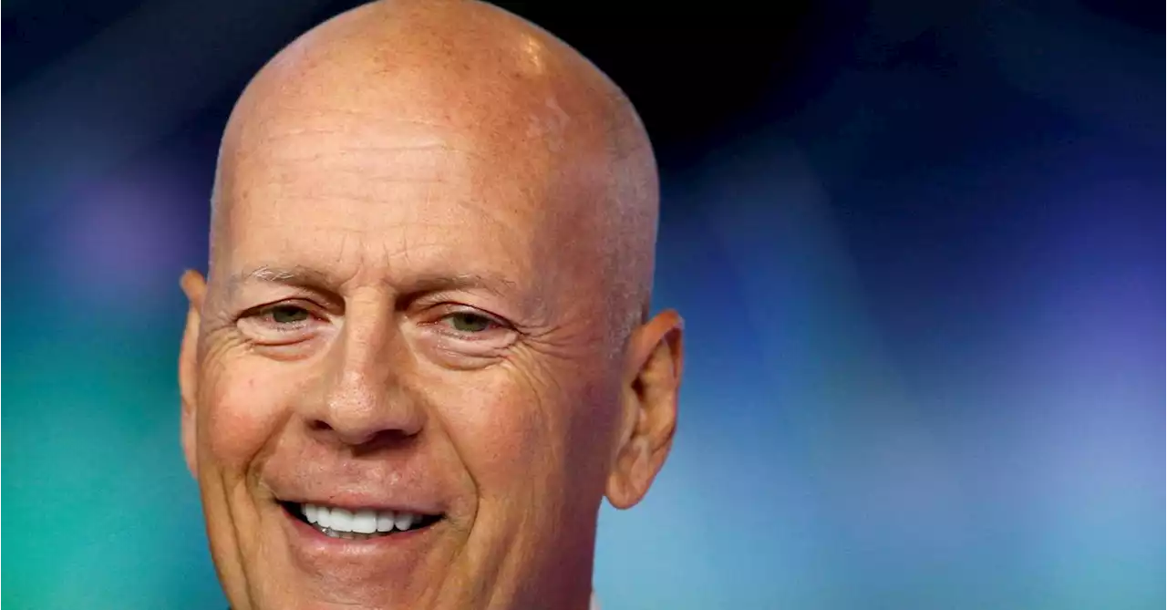 Actor Bruce Willis diagnosed with dementia