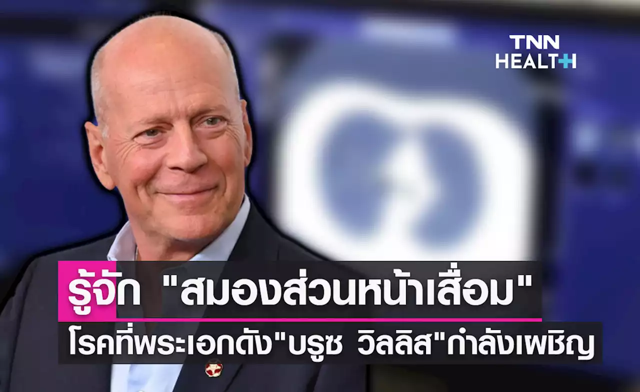 รู้จัก 'สมองส่วนหน้าเสื่อม' โรคที่พระเอกดัง 'บรูซ วิลลิส' กำลังเผชิญ