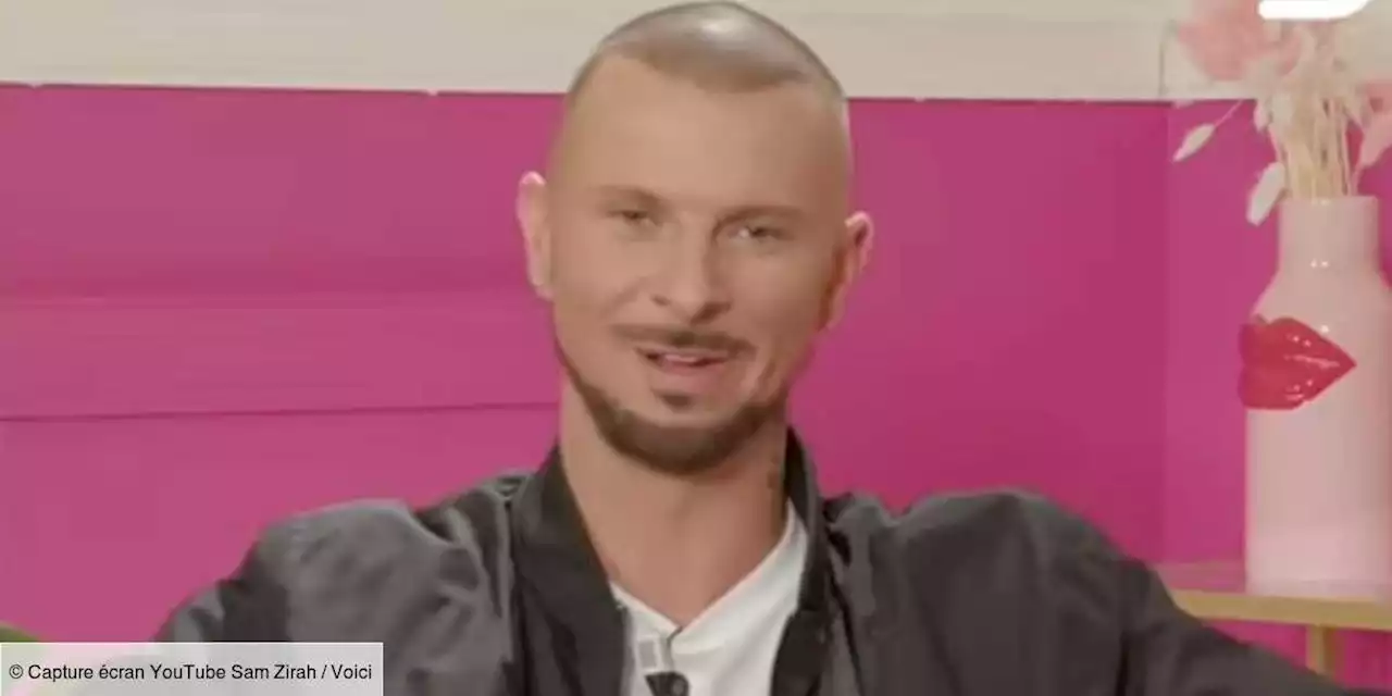 « J’ai juste fait quelque chose à ma peau » : Vincent Shogun se confie sur ses chirurgies esthétiques dans une nouvelle vidéo - Voici