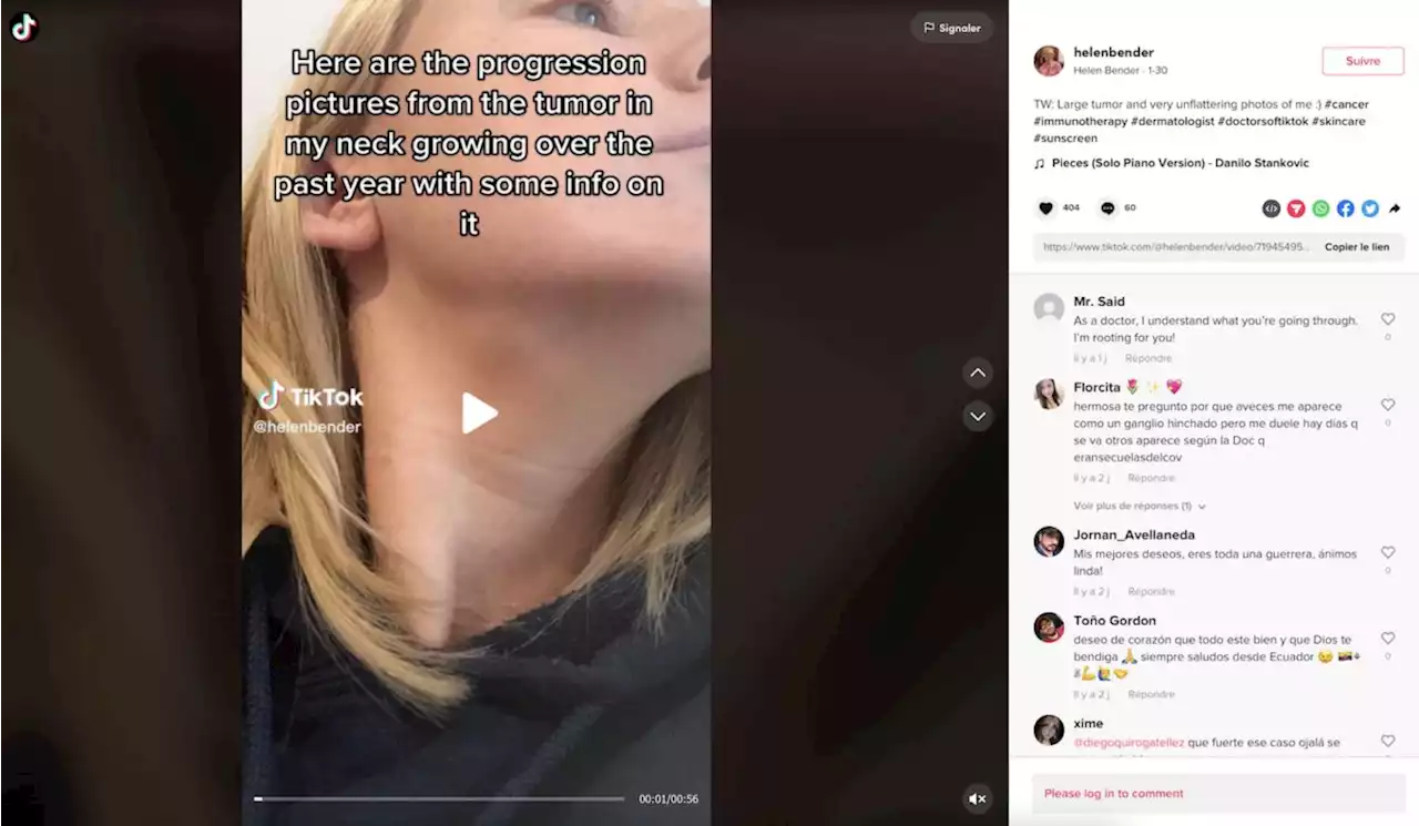 Elle se découvre une grave maladie grâce à une tendance beauté sur TikTok