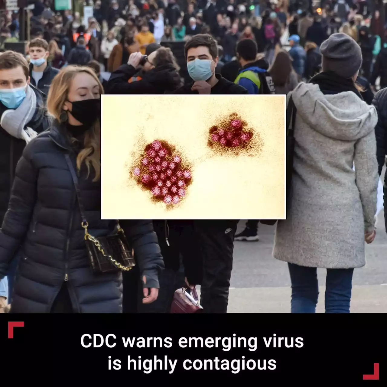 Forget COVID; CDC now warns this virus is highly contagious