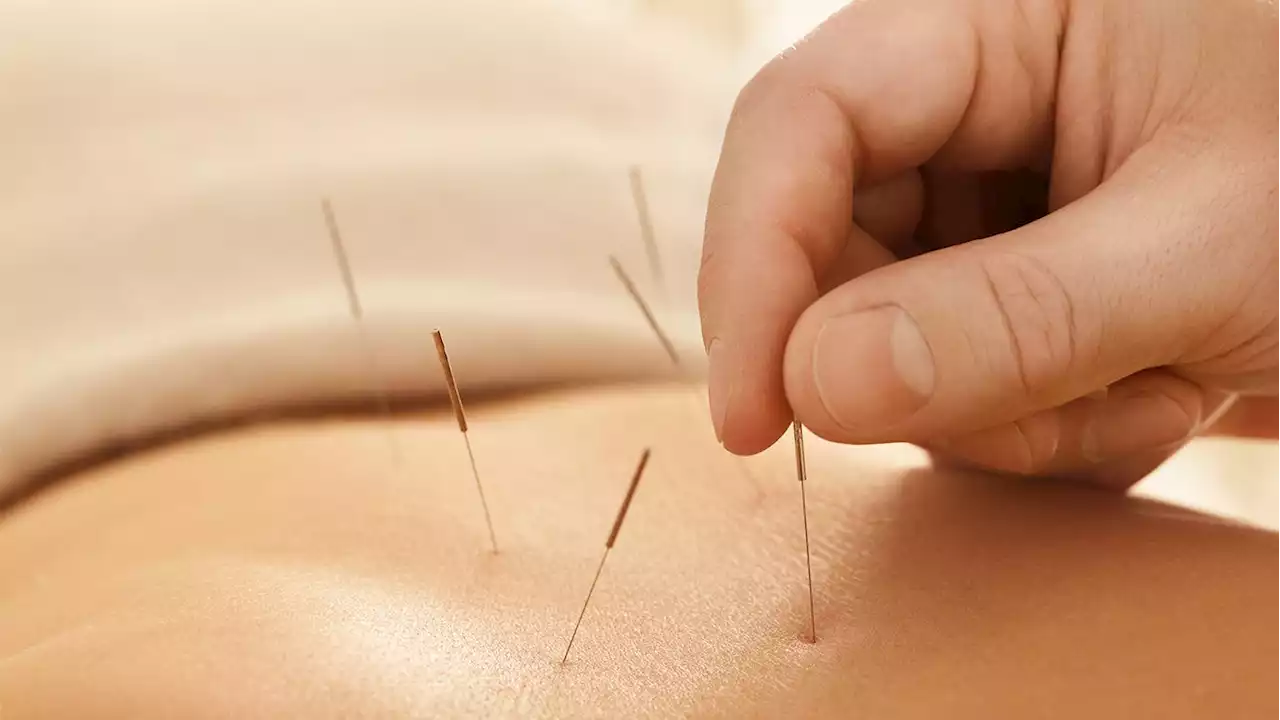 Acupuncture during pregnancy: is it safe?