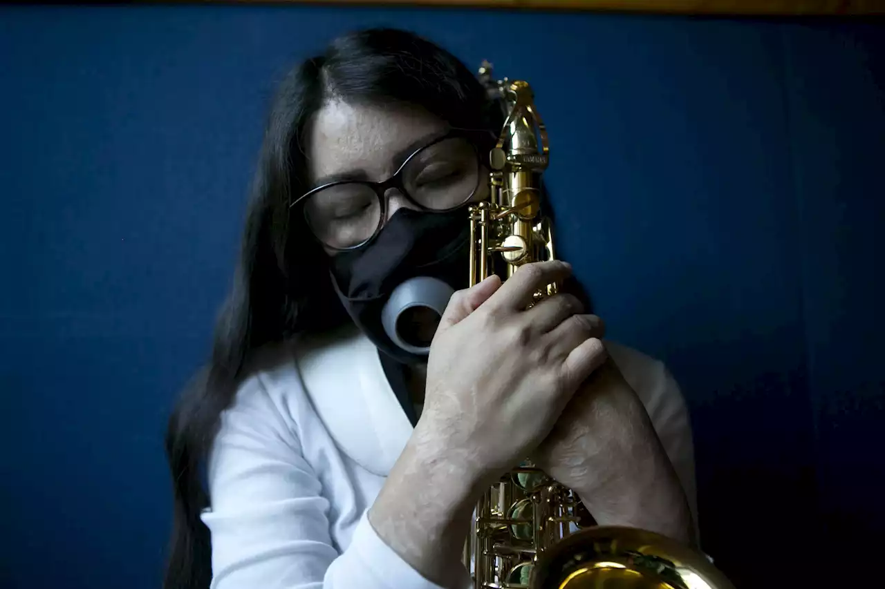 Mexican musician finds refuge in saxophone after acid attack