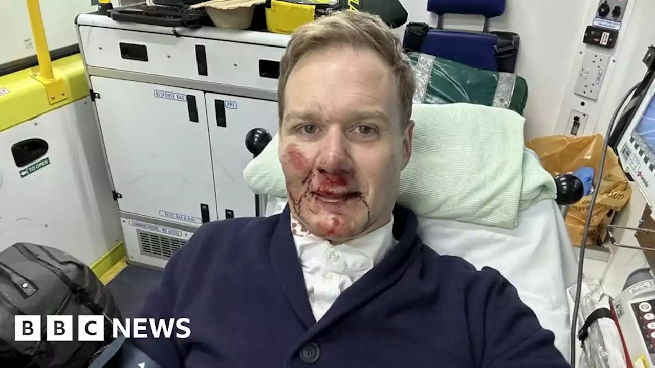 Dan Walker: TV presenter injured in bicycle crash