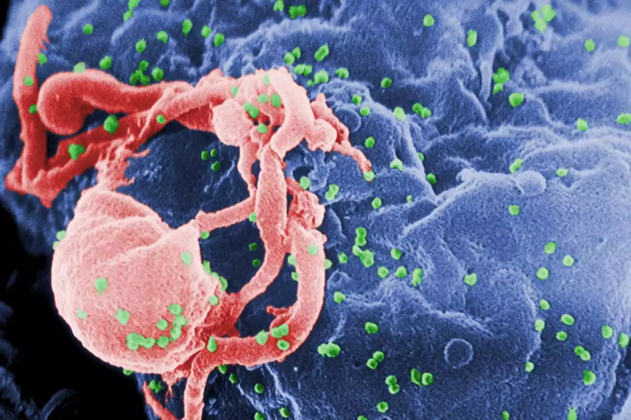 Third person 'cured' of HIV after receiving stem cell cancer treatment