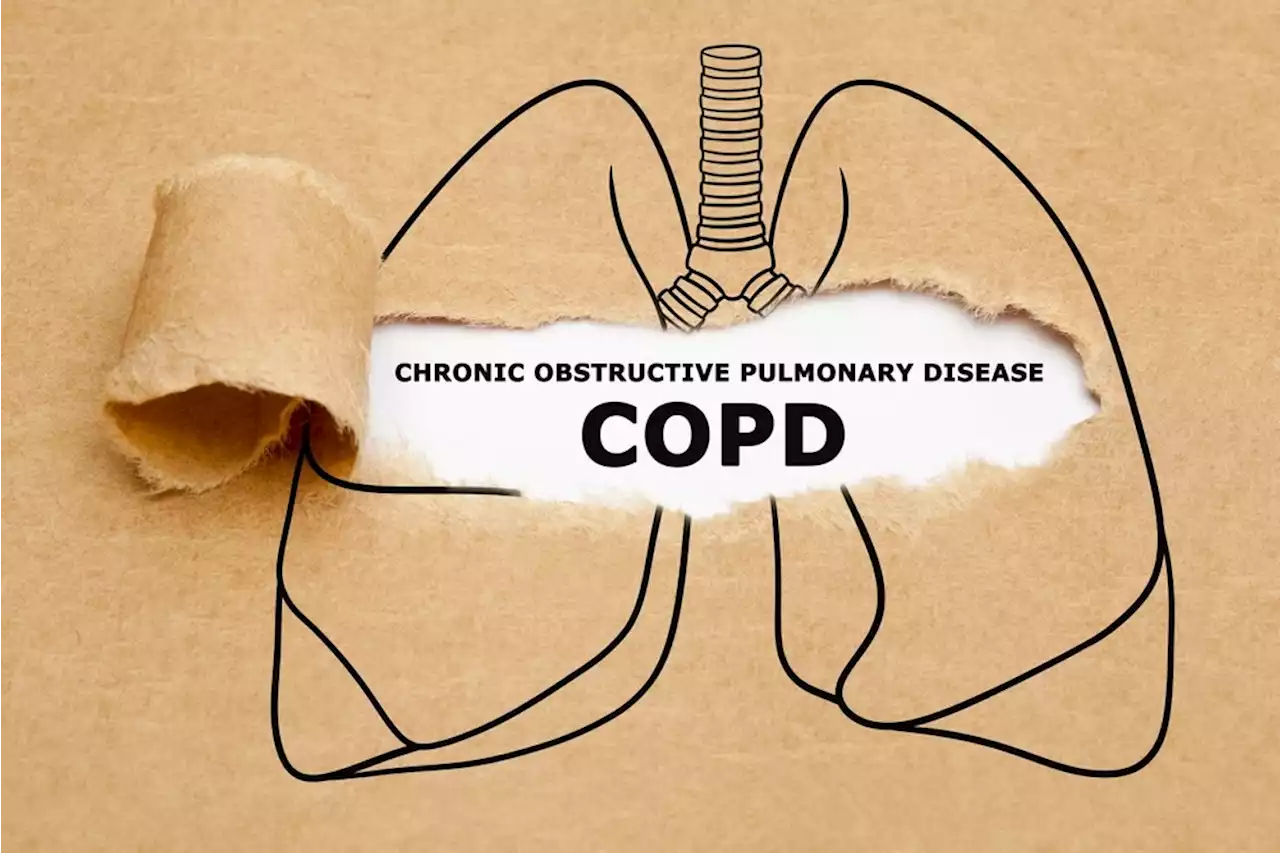 Utilizing CRISPR to discover new therapy options for COPD