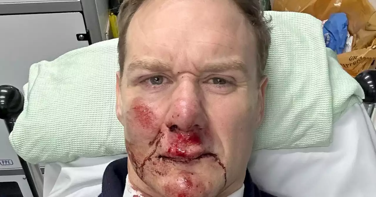 Dan Walker hospitalised after being hit by car while riding his bike