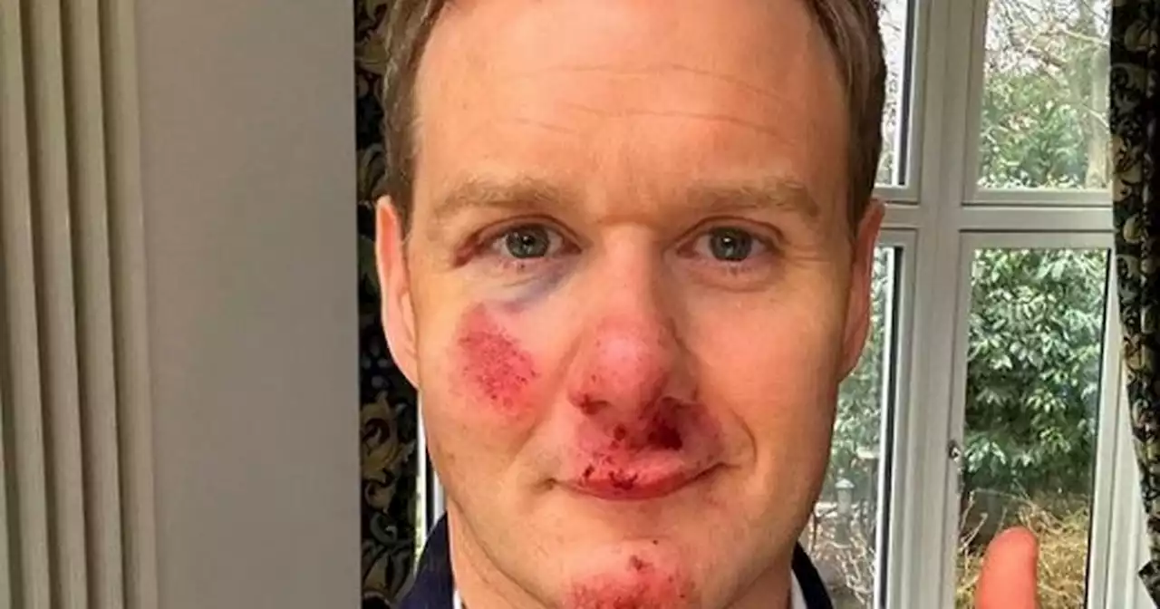 Dan Walker says 'helmet saved his life' after being hit by car while cycling