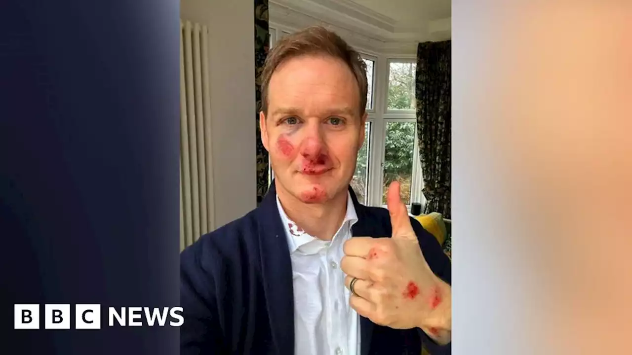 Dan Walker bike accident: Helmet saved my life, says TV star