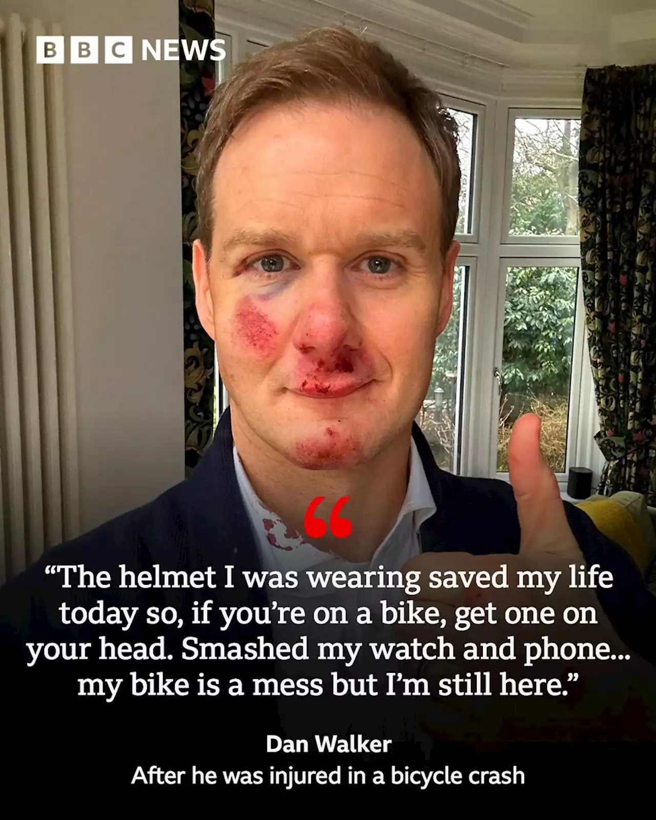 Dan Walker: TV presenter injured in bicycle crash