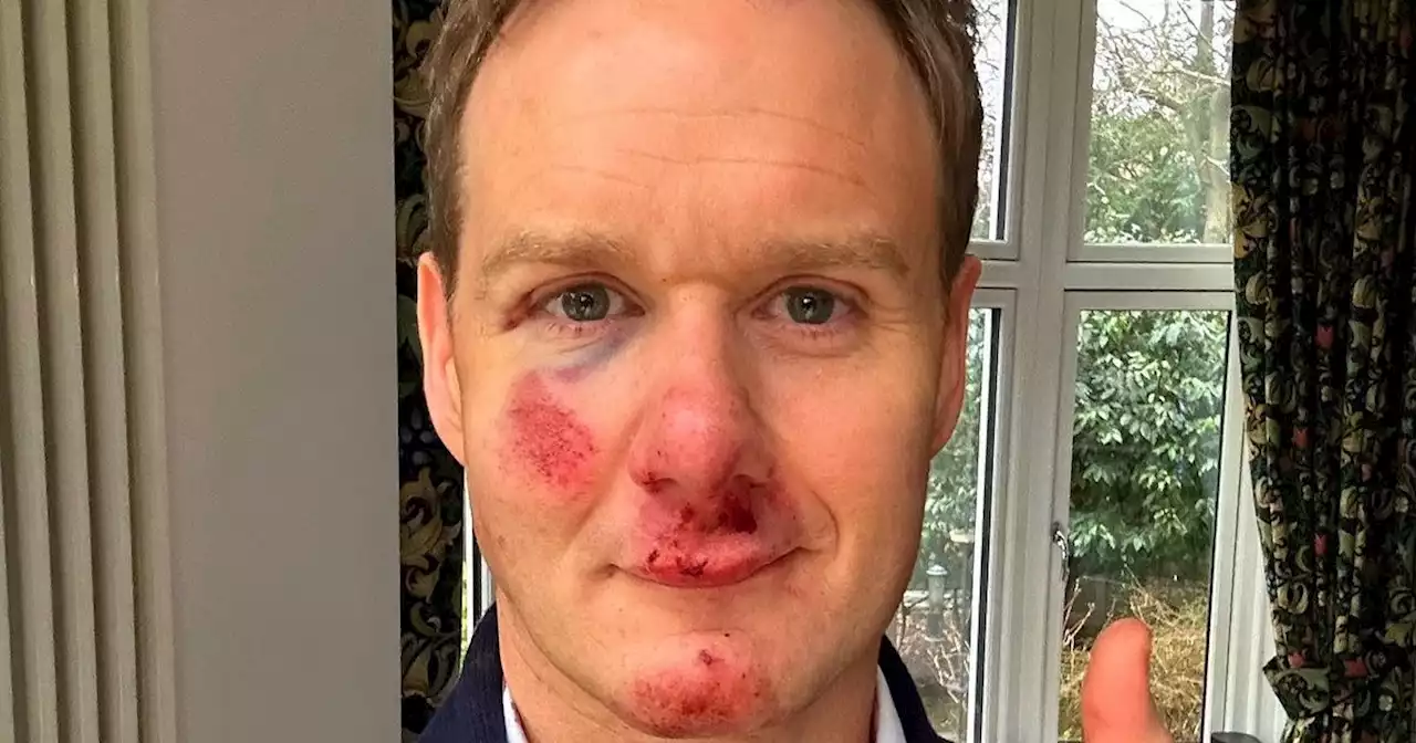 Dan Walker says his helmet saved life as he issues new update following crash