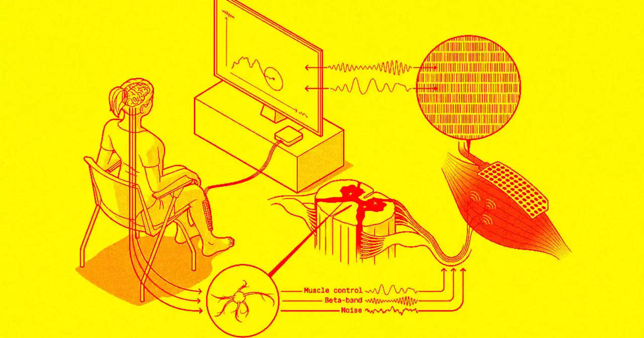 Scientists Working on Third Arm You Control Using Your Brain