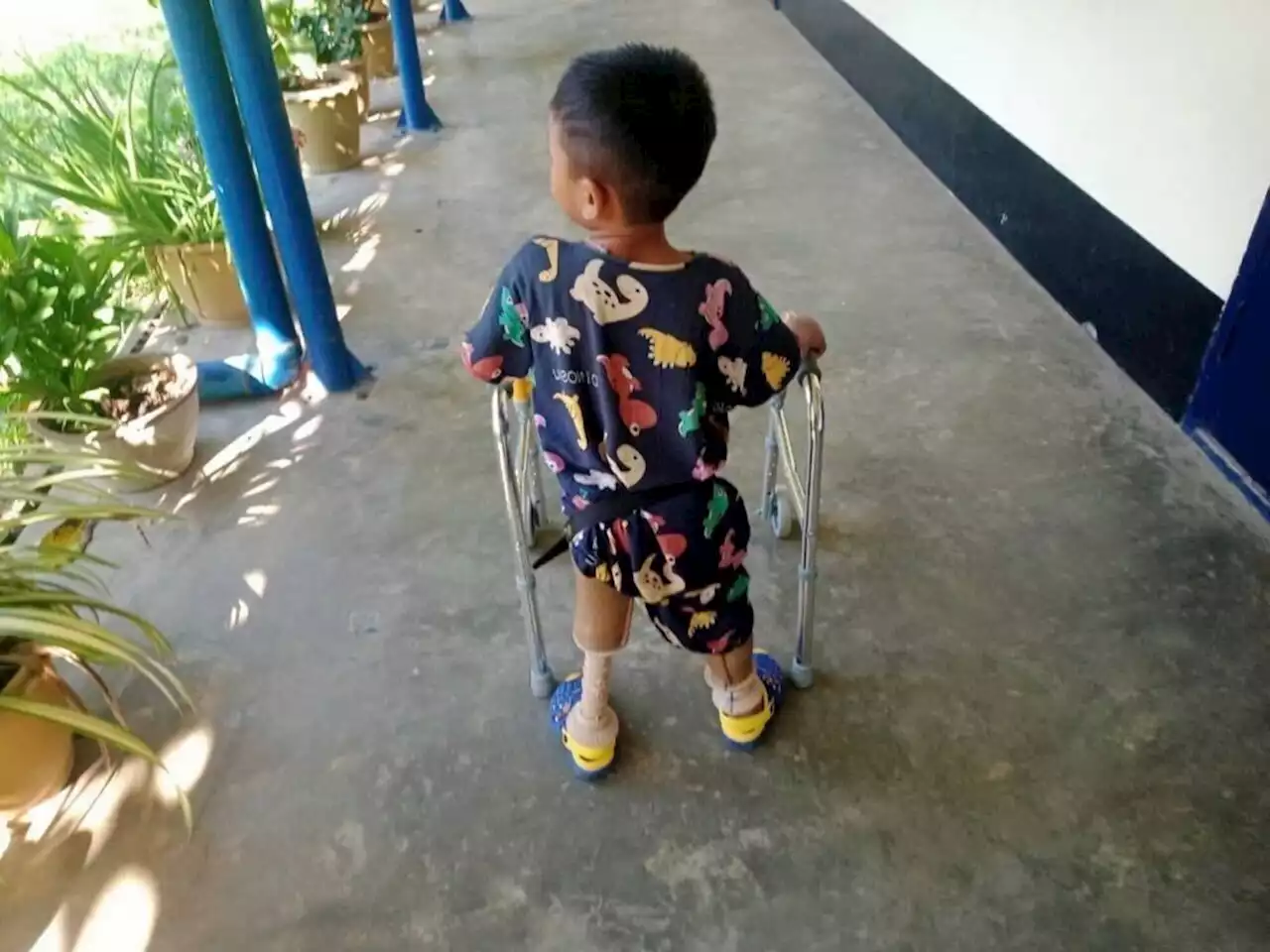 Landmine casualties soar in Myanmar: ‘I just want my legs back’