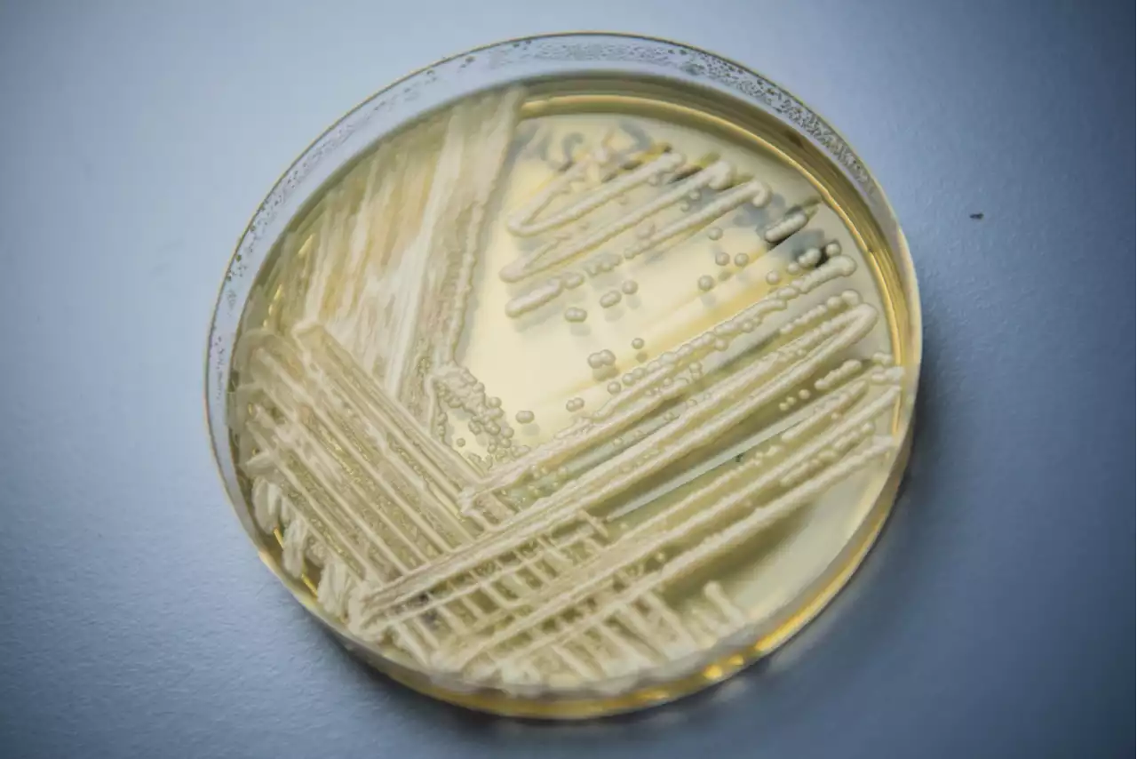 Medicine-resistant fungal infection, C. auris, potentially linked to four deaths in Mississippi