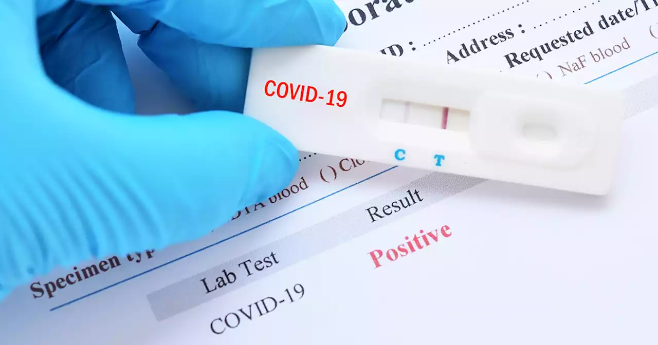 Covid infection gives similar immunity to vaccination: study