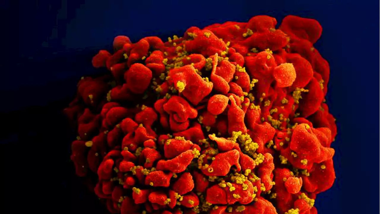 Fifth Man Cured of HIV, Researchers Confirm