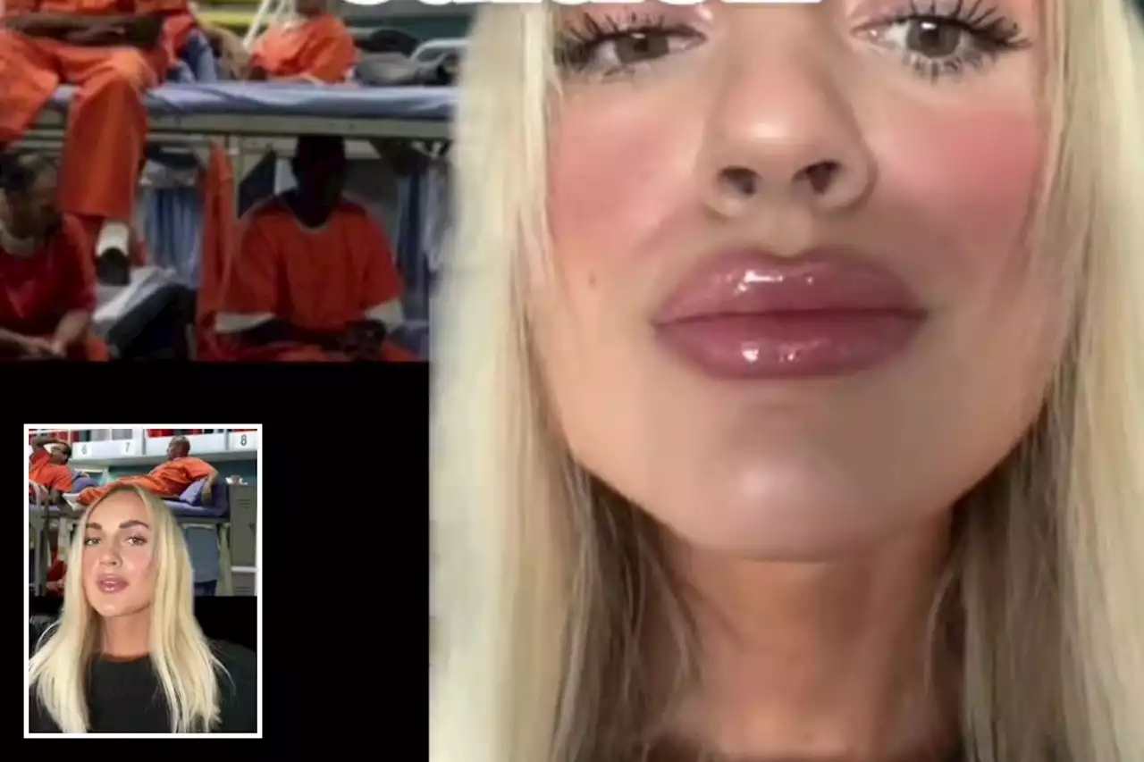 I work in a prison & inmates always ask gross things about my lip fillers