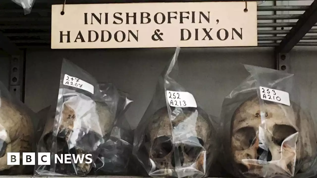 Trinity College Dublin to return skulls to Inishbofin