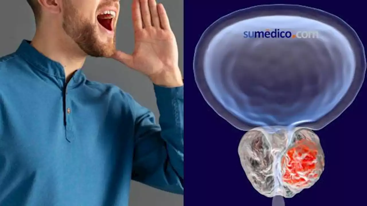 El paciente con cáncer de próstata que desarrolló un acento extranjero